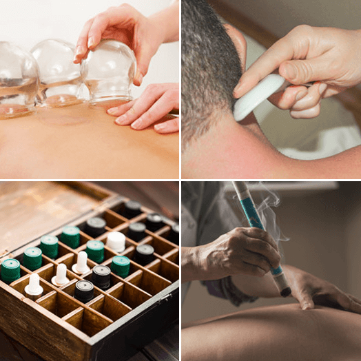 Chinese Cupping, Gua Sha & Moxibustion in the Blue Mountains